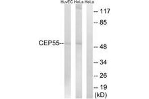 Western blot analysis of extracts from HeLa/HuvEc cells, using CEP55 Antibody. (CEP55 抗体  (AA 81-130))