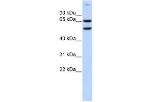 WB Suggested Anti-RELB Antibody Titration:  0.