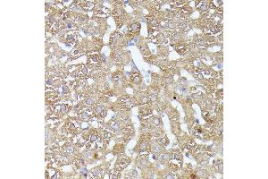 Immunohistochemistry of paraffin-embedded rat liver using CDK5R antibody (ABIN7266235) at dilution of 1:100 (40x lens). (CDK5RAP1 抗体  (AA 1-350))