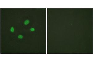 Immunofluorescence staining of methanol-fixed HeLa cells using Chk2 (Phospho-Thr383) Antibody. (CHEK2 抗体  (pThr383))