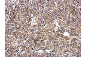 Image no. 1 for anti-BTB (POZ) Domain-Containing Protein KCTD4 (KCTD4) (AA 1-225) antibody (ABIN1499011) (KCTD4 抗体  (AA 1-225))