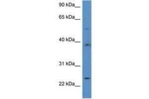 Image no. 1 for anti-Acyl-CoA Thioesterase 9 (Acot9) (AA 356-405) antibody (ABIN6746915) (ACOT9 抗体  (AA 356-405))