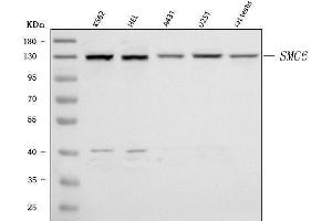 Western blot analysis of SMC6 using anti-SMC6 antibody (ABIN7601864).