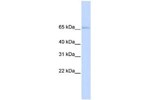 WB Suggested Anti-SLC22A6 Antibody Titration:  0. (SLC22A6 抗体  (N-Term))