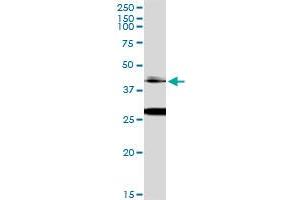 Immunoprecipitation of OTX1 transfected lysate using anti-OTX1 MaxPab rabbit polyclonal antibody and Protein A Magnetic Bead , and immunoblotted with OTX1 monoclonal antibody (M01), clone 1F2 . (OTX1 抗体  (AA 1-354))