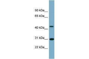 WB Suggested Anti-ARMCX3 Antibody Titration:  0. (ARMCX3 抗体  (Middle Region))