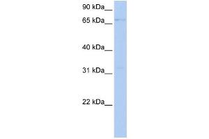 WB Suggested Anti-LSS Antibody Titration:  0. (LSS 抗体  (Middle Region))