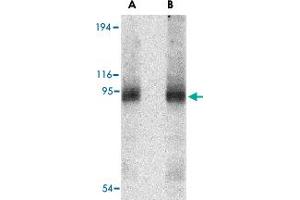 Western blot analysis of CD180 in human spleen tissue lysate with CD180 polyclonal antibody  at (A) 0. (CD180 抗体  (Internal Region))