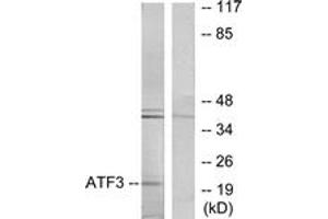 Western blot analysis of extracts from RAW264. (ATF3 抗体  (AA 131-180))
