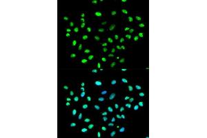 Immunofluorescence analysis of MCF-7 cells using HNRNPK antibody.