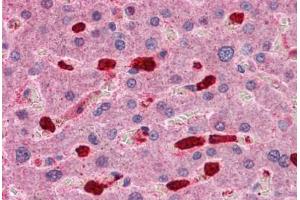 Human Liver: Formalin-Fixed, Paraffin-Embedded (FFPE) (ARHGAP18 抗体  (C-Term))