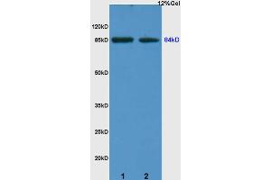 L1 human colon carcinoma lysates L2 rat kidney lysates probed with Anti ARHGAP24 Polyclonal Antibody, Unconjugated (ABIN714716) at 1:200 overnight at 4 °C. (ARHGAP24 抗体  (AA 501-600))
