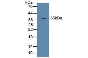 Figure. (DKK1 抗体  (AA 33-266))