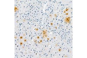 Immunohistochemistry analysis of paraffin embedded mouse Alzheimer',s brainusing Aβ40 (ABIN7073042) at dilution of 1:400 (Abeta 1-40 抗体)