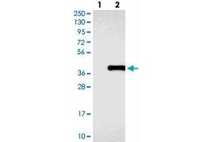 Western blot analysis of Lane 1: Negative control (vector only transfected HEK293T lysate), Lane 2: Over-expression Lysate (Co-expressed with a C-terminal myc-DDK tag (~3. (COLEC11 抗体)