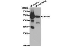 Western Blotting (WB) image for anti-Cytochrome P450, Family 2, Subfamily E, Polypeptide 1 (CYP2E1) antibody (ABIN1872172) (CYP2E1 抗体)
