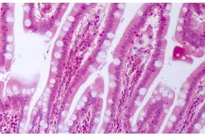 Anti-CTGF antibody IHC staining of human small intestine. (CTGF 抗体)
