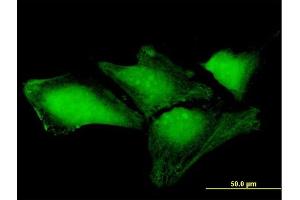Immunofluorescence of purified MaxPab antibody to THAP4 on HeLa cell. (THAP4 抗体  (AA 1-577))