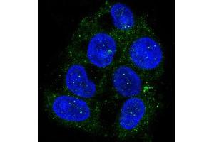 Immunofluorescent analysis of Hepg2 cells, using ATG9A Antibody. (Recombinant ATG9A 抗体)
