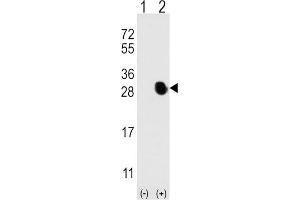 Western Blotting (WB) image for anti-Osteocalcin (BGLAP) antibody (ABIN3001265) (Osteocalcin 抗体)