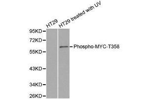 Western blot analysis of extracts from HT29 cells untreated or treated with UV, using phospho-MYC-T358 antibody. (c-MYC 抗体  (pThr358))