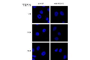 Immunocytochemistry (ICC) image for anti-Vacuolar Protein Sorting 35 (VPS35) antibody (HRP) (ABIN6932999)