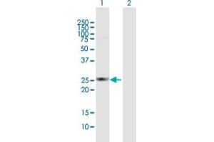 Western Blot analysis of HDHD3 expression in transfected 293T cell line by HDHD3 MaxPab polyclonal antibody. (HDHD3 抗体  (AA 1-251))
