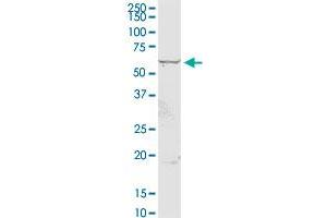 Western Blotting (WB) image for anti-Chondroitin Sulfate N-Acetylgalactosaminyltransferase 2 (CSGALNACT2) (AA 1-542) antibody (ABIN527536)