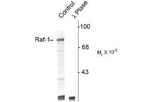 Image no. 1 for anti-V-Raf-1 Murine Leukemia Viral Oncogene Homolog 1 (RAF1) (pSer301) antibody (ABIN372711) (RAF1 抗体  (pSer301))