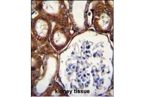 GPX3 Antibody (Center) (ABIN650617 and ABIN2844787) immunohistochemistry analysis in formalin fixed and paraffin embedded human kidney tissue followed by peroxidase conjugation of the secondary antibody and DAB staining. (GPX3 抗体  (AA 93-123))