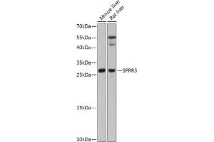 Western blot analysis of extracts of various cell lines, using SPRR3 antibody (ABIN6130714, ABIN6148386, ABIN6148387 and ABIN6215609) at 1:3000 dilution. (SPRR3 抗体  (AA 1-70))
