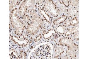 ABIN6279881 at 1/200 staining human kidney tissue sections by IHC-P. (TCEAL8 抗体  (Internal Region))