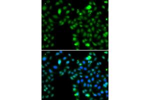 Immunofluorescence analysis of MCF7 cell using ING5 antibody. (ING5 抗体)