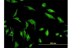 Immunofluorescence of monoclonal antibody to TPMT on HeLa cell. (TPMT 抗体  (AA 1-245))
