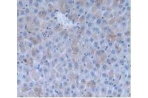 Detection of INHbA in Rat Liver Tissue using Monoclonal Antibody to Inhibin Beta A (INHbA)