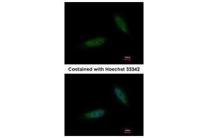 ICC/IF Image Immunofluorescence analysis of paraformaldehyde-fixed HeLa, using TBCK, antibody at 1:200 dilution. (TBCK 抗体)