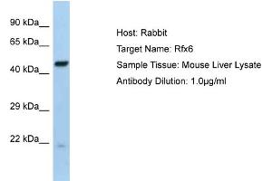 Host:  Rabbit  Target Name:  Rfx6  Sample Type:  Mouse Liver lysates  Antibody Dilution:  1. (RFX6 抗体  (Middle Region))