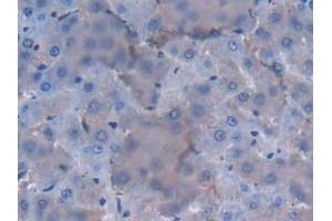 Immunohistochemistry (IHC) image for anti-Interleukin 12 alpha (IL12A) (AA 23-215) antibody (ABIN7430657)