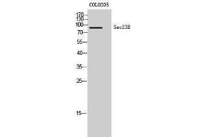 Western Blotting (WB) image for anti-Sec23 Homolog B (SEC23B) (Internal Region) antibody (ABIN3177351) (Sec23 Homolog B 抗体  (Internal Region))
