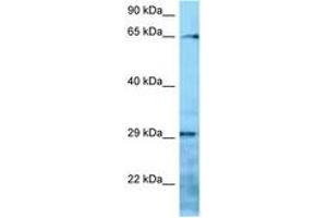 Image no. 1 for anti-Villin-Like (VILL) (AA 176-225) antibody (ABIN6748301) (VILL 抗体  (AA 176-225))