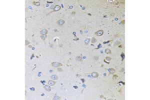 Immunohistochemistry of paraffin-embedded rat brain using MEMO1 antibody  at dilution of 1:100 (40x lens). (MEMO1 抗体  (AA 1-297))