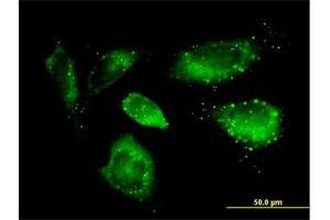 Immunofluorescence of purified MaxPab antibody to SQSTM1 on HeLa cell. (SQSTM1 抗体  (AA 1-440))