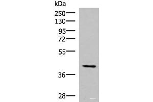 Western blot analysis of Hela cell lysate using IST1 Polyclonal Antibody at dilution of 1:1000 (IST1 抗体)