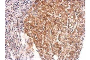 IHC-P Image Cyclophilin 40 antibody detects PPID protein at cytosol on human hepatoma by immunohistochemical analysis. (PPID 抗体)