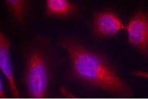 Image no. 1 for anti-Microtubule-Associated Protein tau (MAPT) (Ser214) antibody (ABIN401618) (MAPT 抗体  (Ser214))