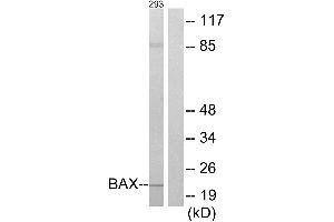Immunohistochemistry analysis of paraffin-embedded human liver carcinoma tissue using BAX antibody. (BAX 抗体)