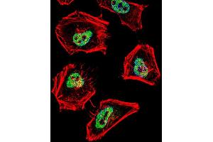 Immunofluorescence (IF) image for anti-Nuclear Receptor Co-Repressor 1 (NCOR1) (AA 16-47), (N-Term) antibody (ABIN387976)