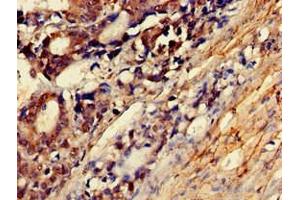 Immunohistochemistry of paraffin-embedded human smooth muscle tissue using ABIN7160538 at dilution of 1:100 (MYLK 抗体  (AA 290-398))