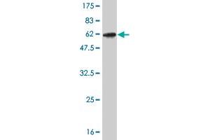 Western Blot detection against Immunogen (52. (CLIC1 抗体  (AA 1-241))