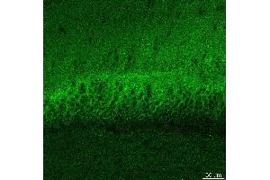 Indirect immunostaining PFA fixed hippocampus sections (dilution 1 : 500). (DLG3 抗体)